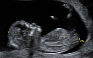 baby, mother's day, grandmother, unborn